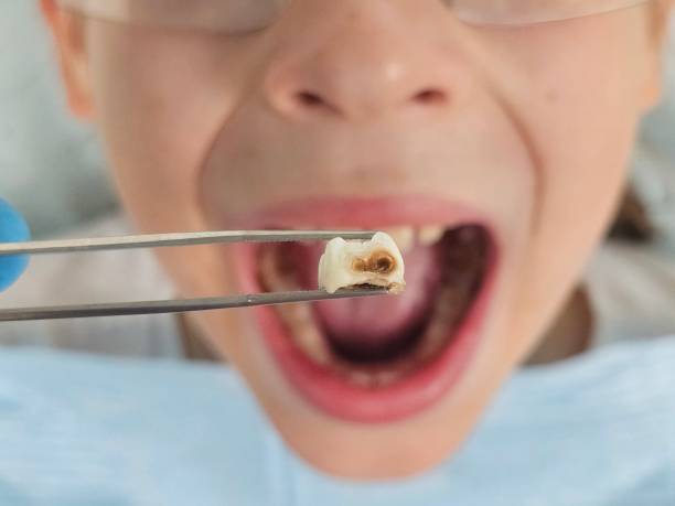 Best Mobile Emergency Dentist in Mount Pleasant, IA