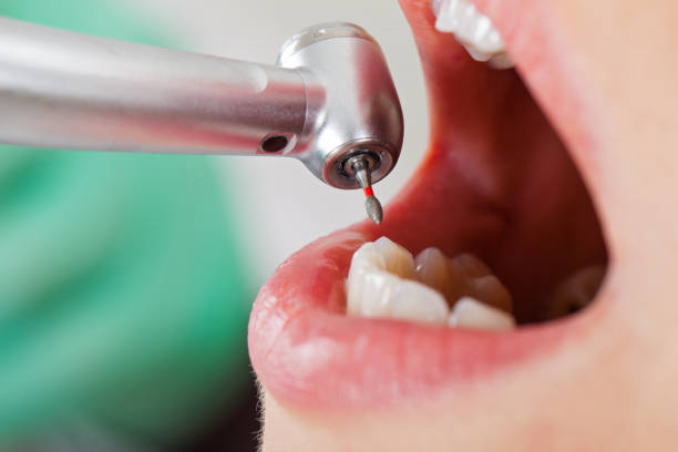 Best Orthodontic Emergency Dentist in Mount Pleasant, IA